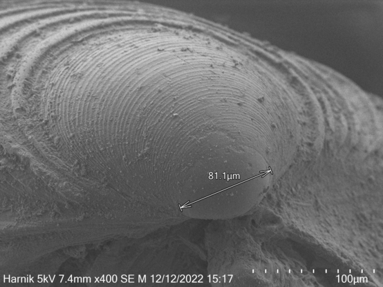 Scanning electron micrograph of the larval shell of a marine bivalve, Semelina nuculoides