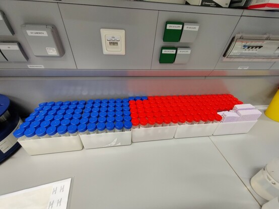Heat extraction sample waiting to be processed.