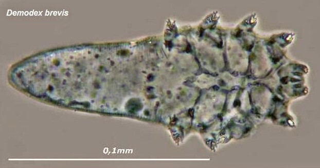 A micrograph of Demodex brevis via Austin Whittall. https://commons.m.wikimedia.org/wiki/File:Demodex_Brevis.jpg#mw-jump-to-license