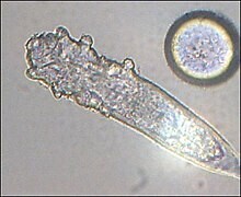 A micrograph of Demodex folliculorum via https://commons.m.wikimedia.org/wiki/File:Haarbalgmilbe.jpg#mw-jump-to-license