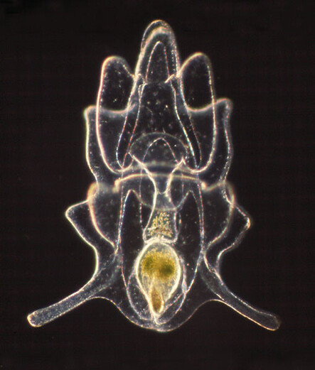 Convoluted transparent microscope image of a starfish larva against a black background.