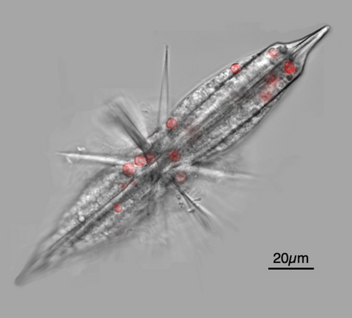 image/png a microscopic image of a transparent elongated organism with spines radiating from the center, with distinctly red spherical dots inside. Size bar of 20 microns suggests the organism is 200 microns long.

Fluorescent micrograph of an acantharian with Phaeocystis symbionts.
https://commons.m.wikimedia.org/wiki/File:Acantharia_confocial_micrograph_2.png