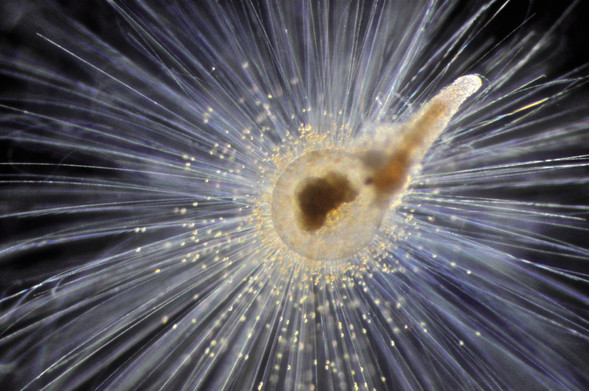 image/jpeg microscope photograph of a tadpole shaped yellow structure with hundreds of long radiating spines. Tiny dots surround the central axis.
Photo: Howard J. Spero, University of California, Davis.

