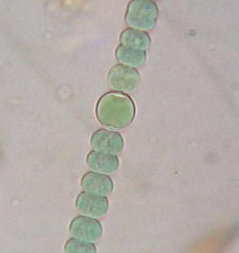 image/jpeg a microscope image of a filament of cells that are slightly bluish-green coloured. Anabaena sphaerica CC-BY-SA 3.0.