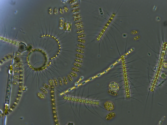 image/png a microscope image of a variety of golden-coloured algae forms, with some forming long chains of cells while others are single-celled. Photo from Stephanie Anderson, University of Rhode Island, public domain.